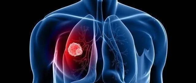 肿瘤标志物在肺癌免疫治疗中的研究进展