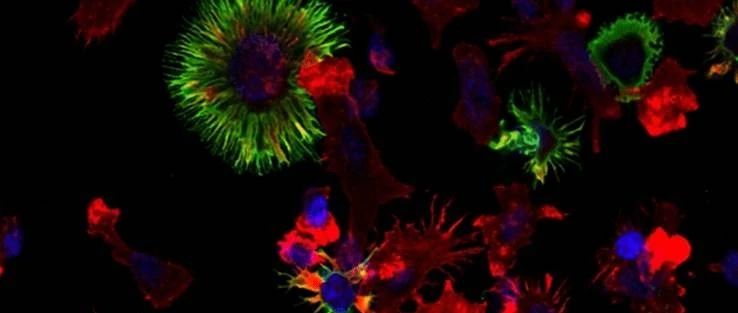 肿瘤干细胞临床应用研究进展