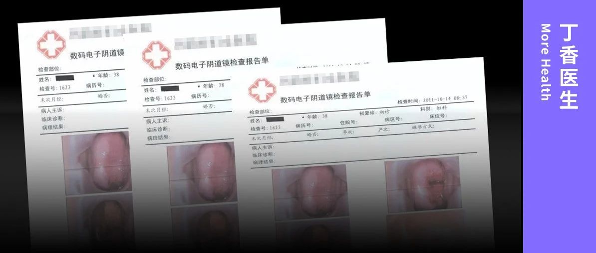 曝光 14 年的妇科骗局，还在专坑中国女性